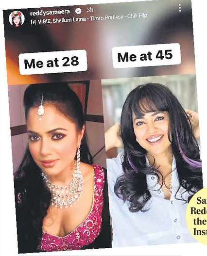 Sameera reveals being ‘pressured to get a boob job’ Sameera reveals being ‘pressured to get a boob job’