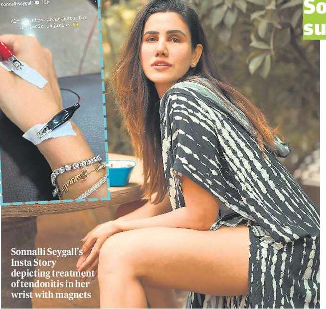 Sonnalli picks acupuncture over surgery for wrist tendonitis